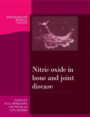 Mika V. J. Hukkanen, Julia M. Polak, Sean P. F. Hughes - Nitric Oxide in Bone and Joint Disease, Häftad