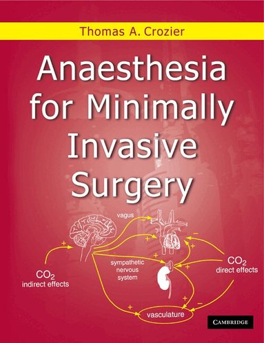 Thomas Allen Crozier - Anaesthesia for Minimally Invasive Surgery, Häftad