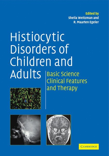 Histiocytic Disorders of Children and Adults 1