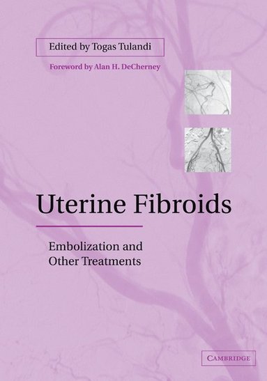 bokomslag Uterine Fibroids