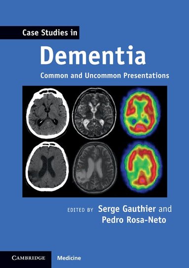 Serge Gauthier, Pedro Rosa-Neto - Case Studies in Dementia: Volume 1, Häftad