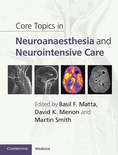 Core Topics in Neuroanaesthesia and Neurointensive Care 1