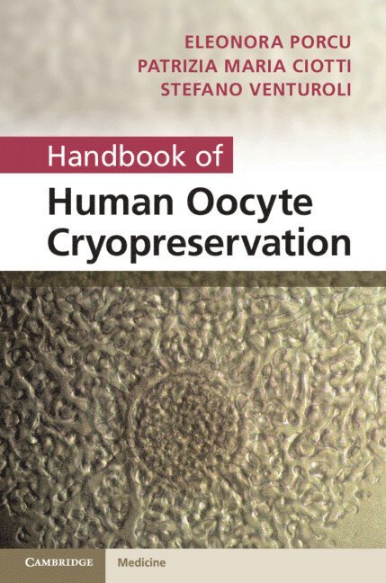 Handbook of Human Oocyte Cryopreservation 1