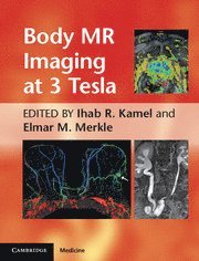 bokomslag Body MR Imaging at 3 Tesla