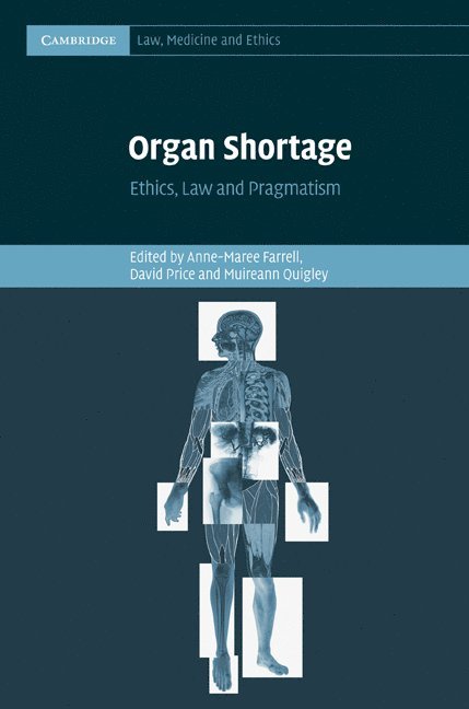 Organ Shortage 1