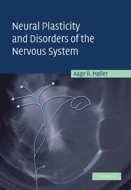 Aage R. M&#248;ller, Aage R. Møller, Dallas) Møller, Aage R. (University of Texas, Aage R. Moller, Aage R. M. Ller - Neural Plasticity and Disorders of the Nervous System, Häftad