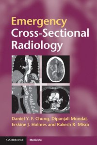bokomslag Emergency Cross-sectional Radiology