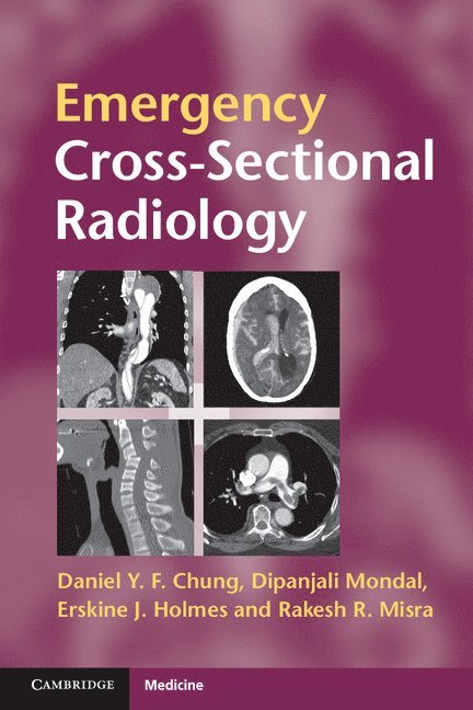 Daniel Y. F. Chung, Dipanjali Mondal, Erskine J. Holmes, Rakesh Misra, Daniel Y F Chung, Erskine J Holmes - Emergency Cross-sectional Radiology, Häftad