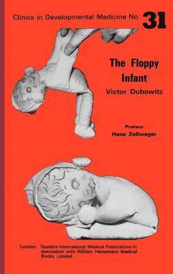 Victor Dubowitz - The Floppy Infant, Inbunden