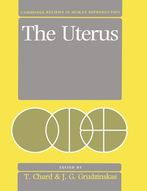 Tim Chard, Chard, T. (St Bartholomew's Hospital Medical College) Chard, J. G. (The Royal London Hospital ) Grudzinskas, J. Gedes Grudzinskas - The Uterus, Häftad