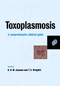 bokomslag Toxoplasmosis