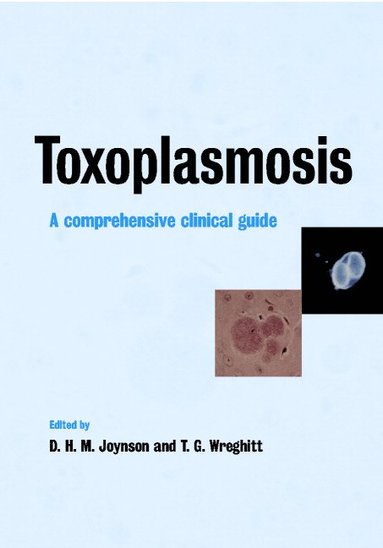 bokomslag Toxoplasmosis