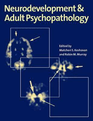 Matcheri S. Keshavan, Robin M. Murray - Neurodevelopment and Adult Psychopathology, Häftad