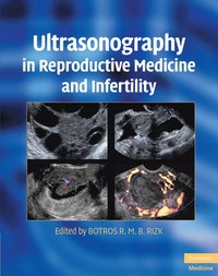 bokomslag Ultrasonography in Reproductive Medicine and Infertility