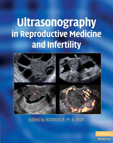 Botros R. M. B. Rizk - Ultrasonography in Reproductive Medicine and Infertility, Inbunden