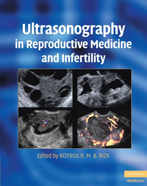 Ultrasonography in Reproductive Medicine and Infertility 1