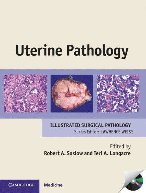 Uterine Pathology 1