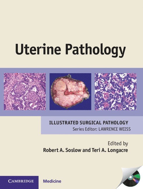 Robert A. Soslow, Teri A. Longacre, New York) Soslow, Robert A., M.D. (Memorial Sloan-Kettering Cancer Center, California) Longacre, Teri A., M.D. (Stanford University School of Medicine - Uterine Pathology, Inbunden
