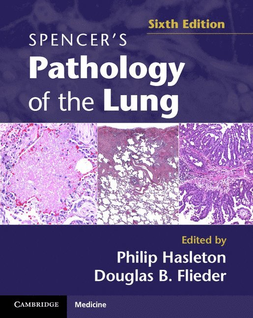 Spencer's Pathology of the Lung 2 Part Set with DVDs 1