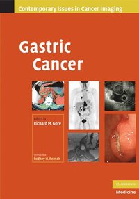 bokomslag Gastric Cancer