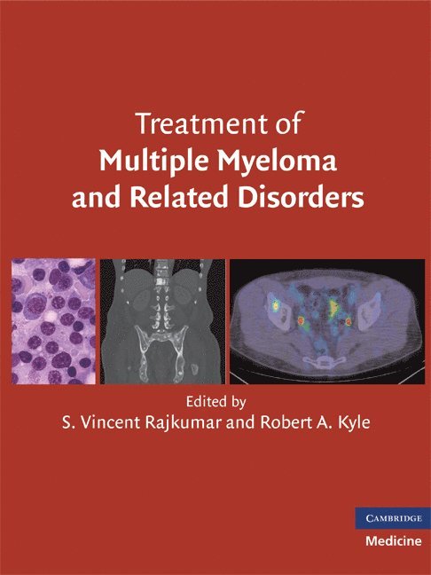 S. Vincent Rajkumar, Robert A. Kyle - Treatment of Multiple Myeloma and Related Disorders, Inbunden
