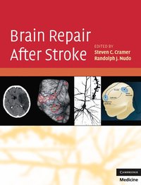 bokomslag Brain Repair After Stroke