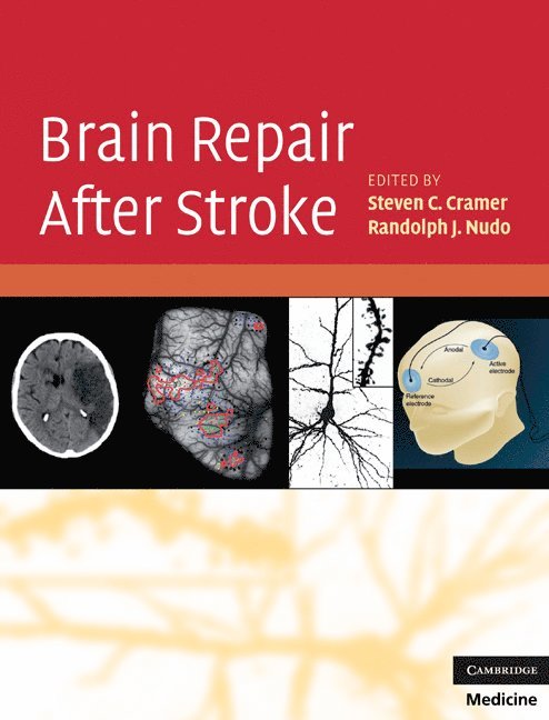 Brain Repair After Stroke 1