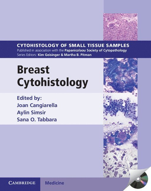 Breast Cytohistology with DVD-ROM 1