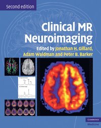 bokomslag Clinical MR Neuroimaging