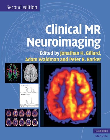 Jonathan H. Gillard, Adam D. Waldman, Peter B. Barker - Clinical MR Neuroimaging, Inbunden