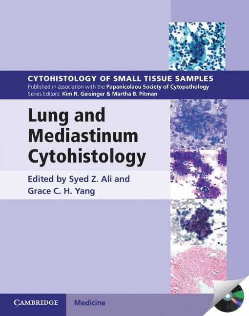 Lung and Mediastinum Cytohistology with CD-ROM 1