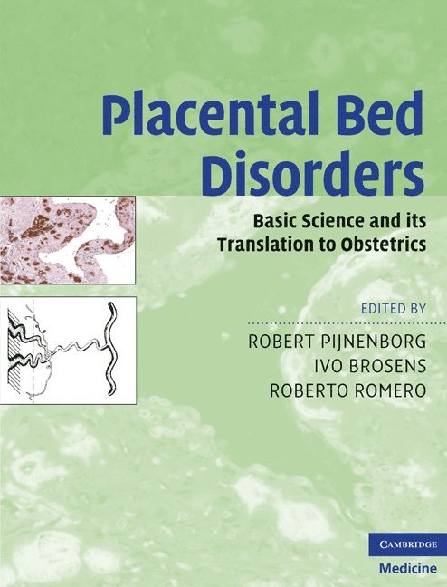 Placental Bed Disorders 1