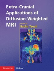 bokomslag Extra-Cranial Applications of Diffusion-Weighted MRI