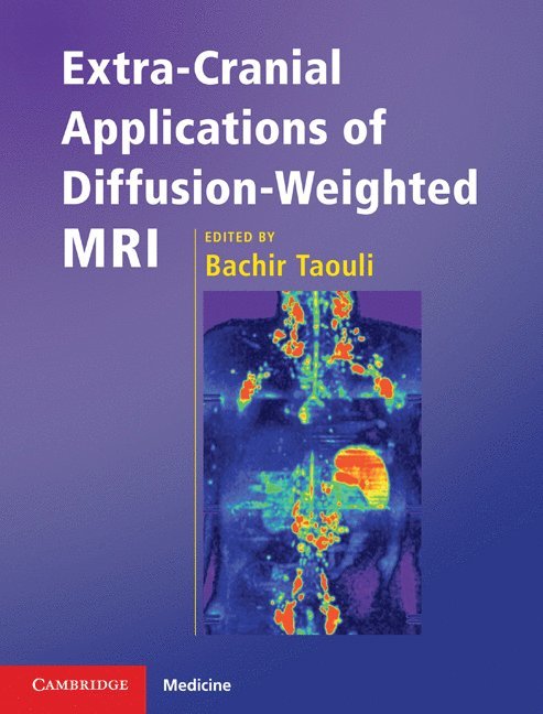 Bachir Taouli, New York) Taouli, Bachir (Mount Sinai School of Medicine - Extra-Cranial Applications of Diffusion-Weighted MRI, Inbunden