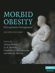 bokomslag Morbid Obesity