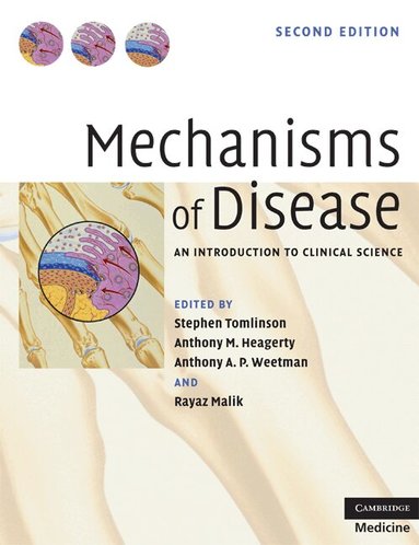 Stephen Tomlinson, Anthony M. Heagerty, Anthony P. Weetman, Rayaz A. Malik - Mechanisms of Disease, Häftad
