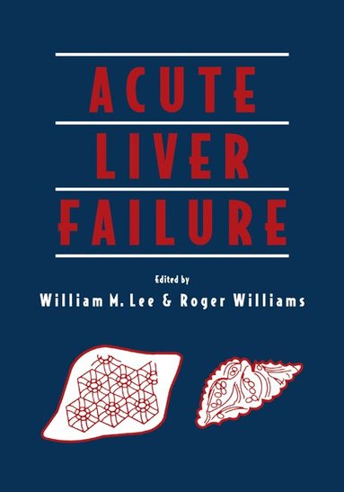 William M. Lee, Roger Williams - Acute Liver Failure, Inbunden