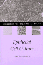 Epithelial Cell Culture 1