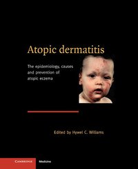 bokomslag Atopic Dermatitis