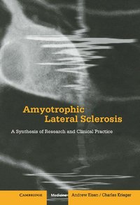 bokomslag Amyotrophic Lateral Sclerosis
