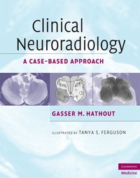 bokomslag Clinical Neuroradiology