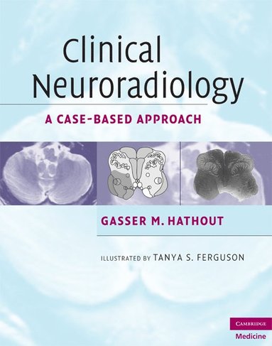 bokomslag Clinical Neuroradiology