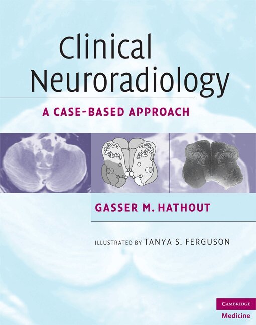 Gasser M. Hathout - Clinical Neuroradiology, Inbunden