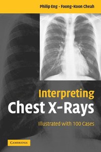 bokomslag Interpreting Chest X-Rays