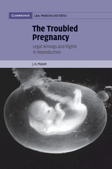 J. K. Mason - The Troubled Pregnancy, Häftad