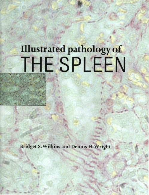 Illustrated Pathology of the Spleen 1