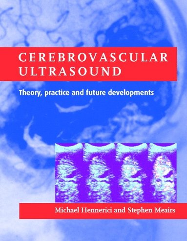 bokomslag Cerebrovascular Ultrasound