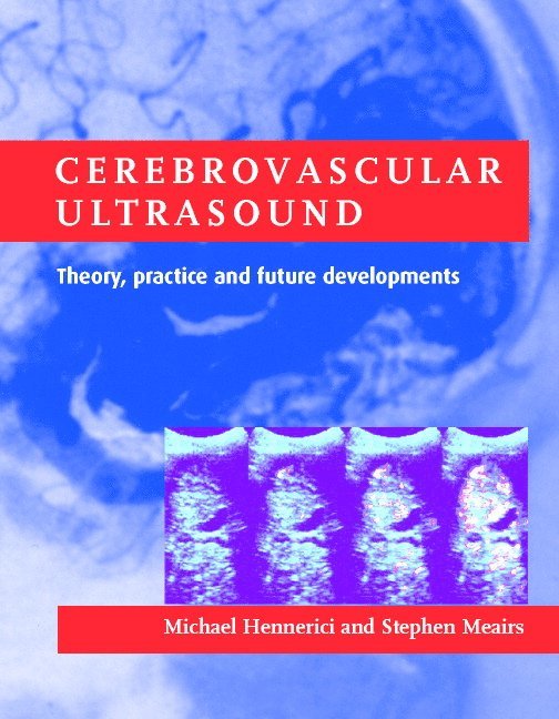 Cerebrovascular Ultrasound 1