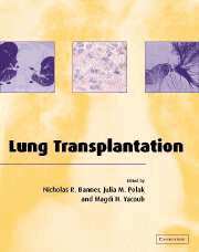 Nicholas R. Banner, Julia M. Polak, Magdi H. Yacoub - Lung Transplantation, Inbunden