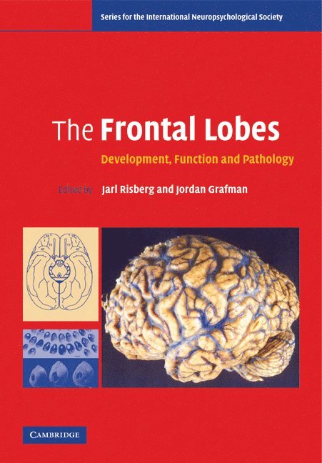 Sweden) Risberg, Jarl (Lunds Universitet, Jordan Grafman, Jarl Risberg - The Frontal Lobes, Häftad